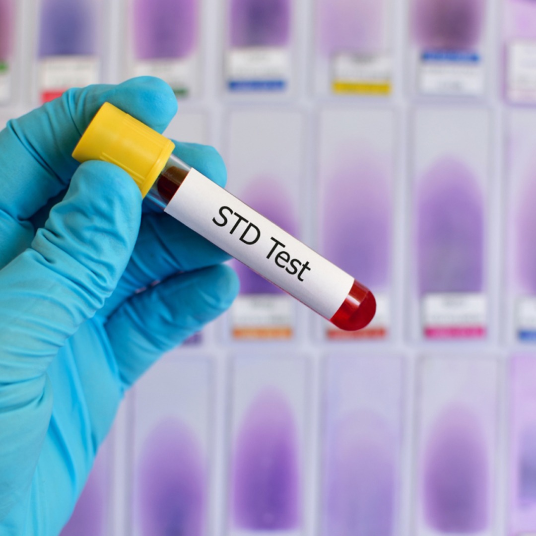 STD TESTING AND TREATMENT