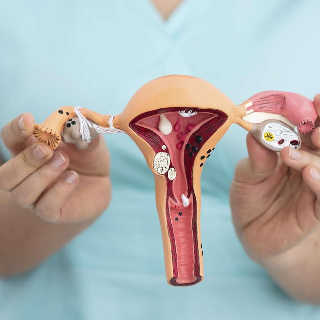 GYNECOLOGY ONCOLOGY at Navjeevan hospital, best hospital in Panipat