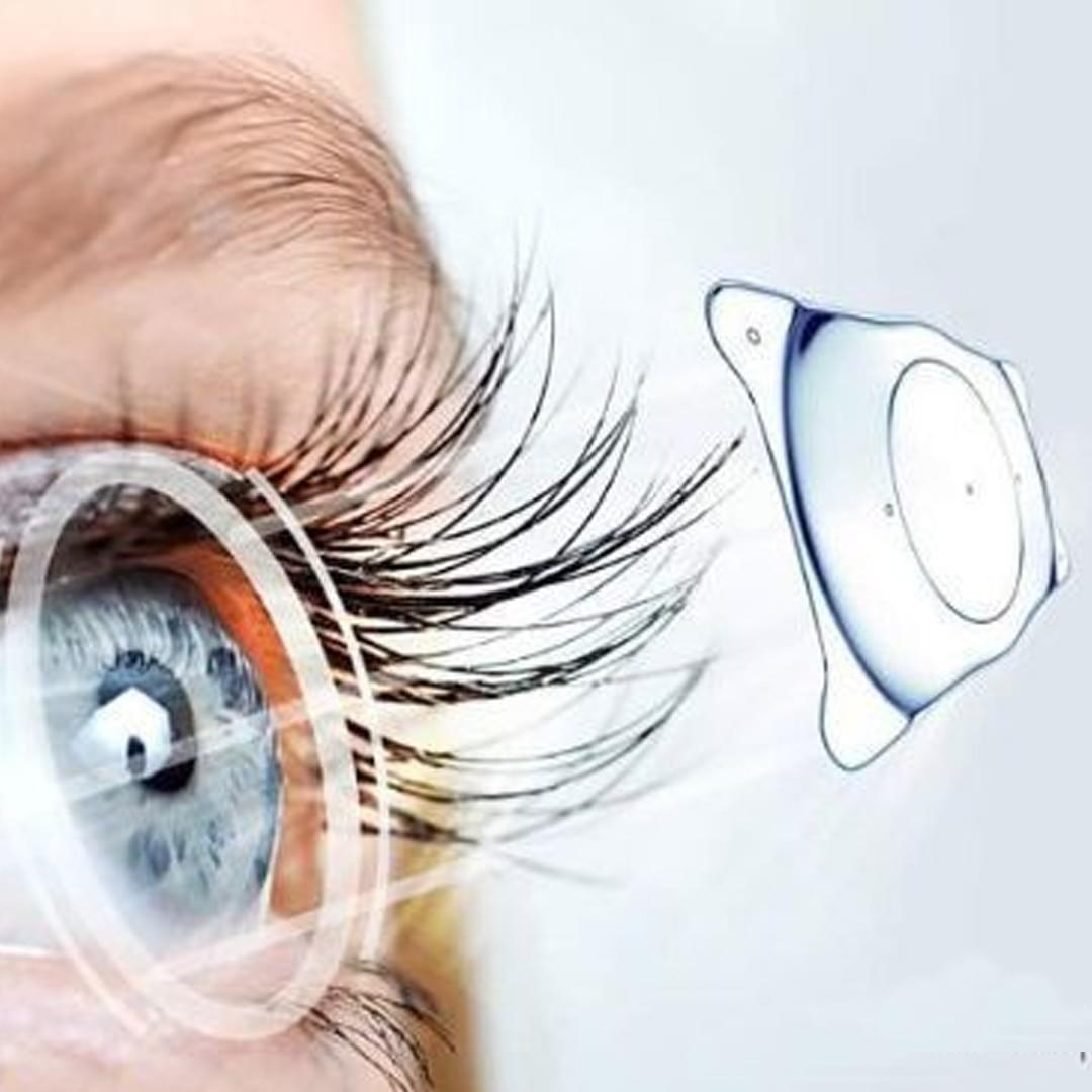 icl treatment at Navjeevan hospital, best hospital in Panipat